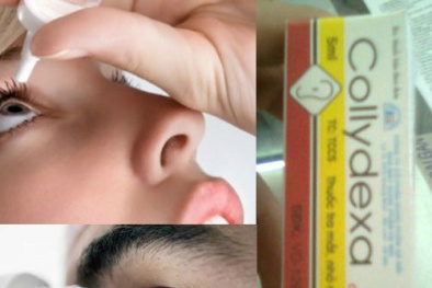 Trôi nổi thị trường thuốc nhỏ mắt chứa Corticoid